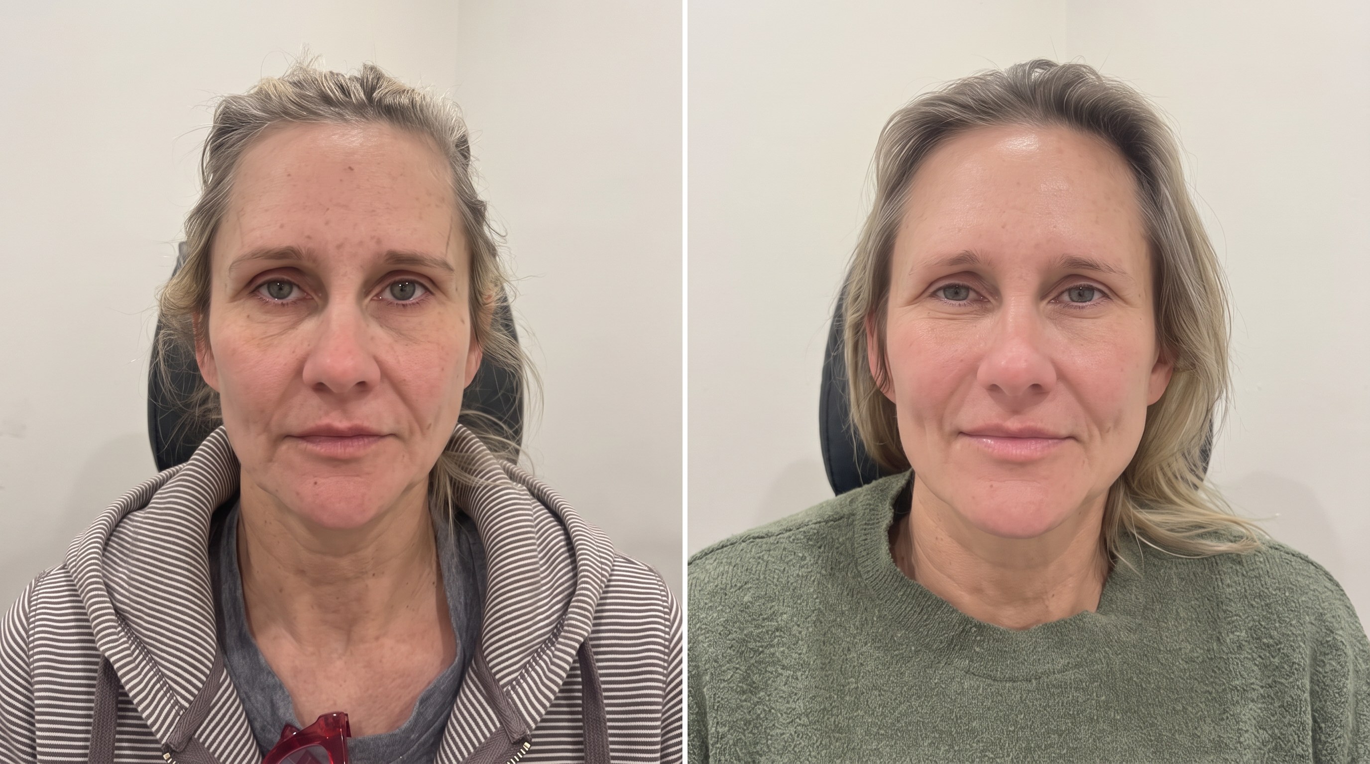 Customer-submitted before-and-after photo from Melissa R., showing her face before and after her skincare routine.