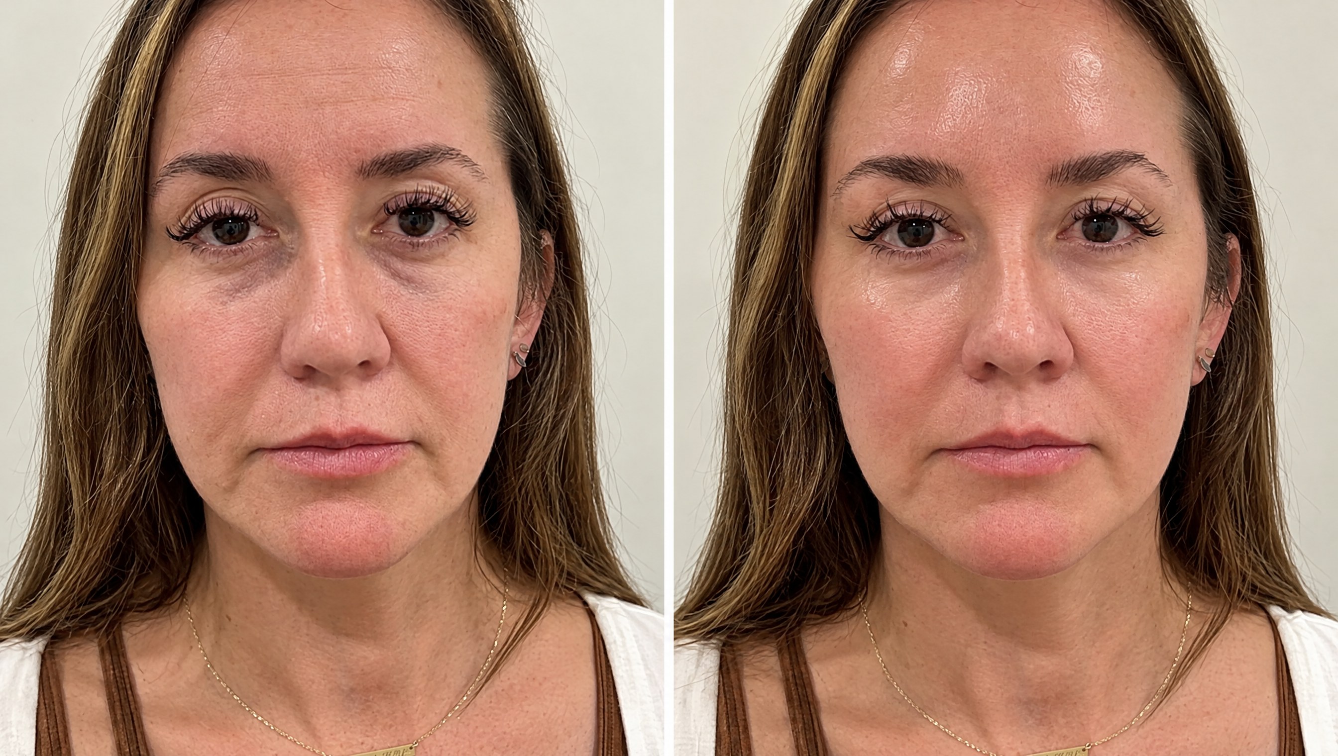 Customer-submitted before-and-after photo from Patricia M. showing her face before and after her skincare routine.